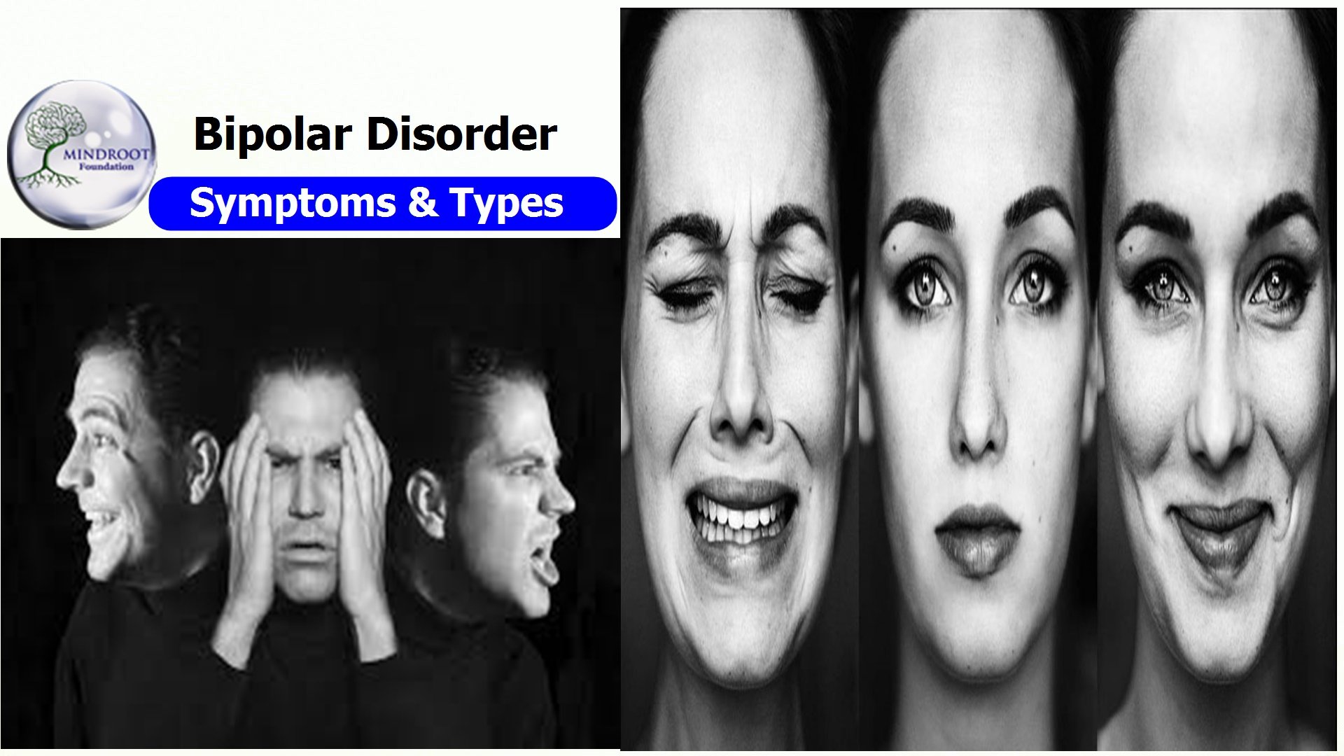 About Bipolar Disorder, Symptoms,Types & Treatment
