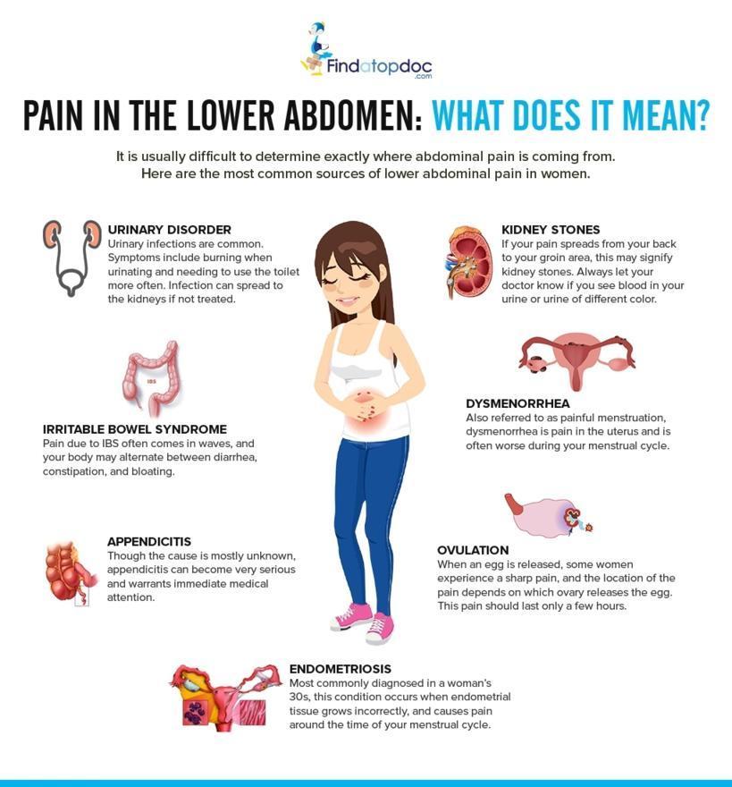 Female Abdominal Pain [Infographic]