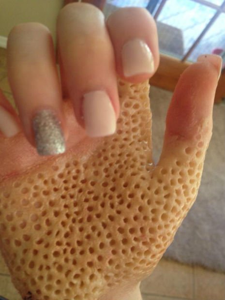 Freaking people out who suffer from Trypophobia (fear of ...