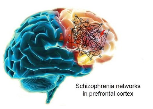 Is Schizophrenia like the Movies? â Cobbers on the Brain