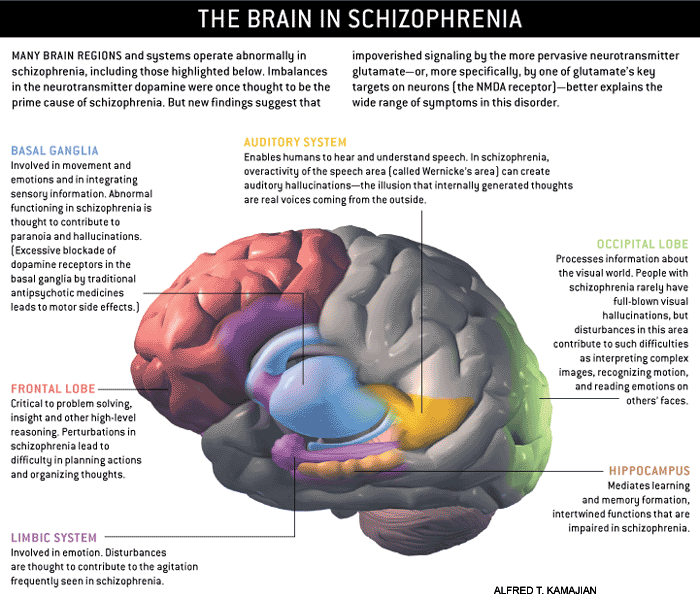Schizophrenia: Summing it Up