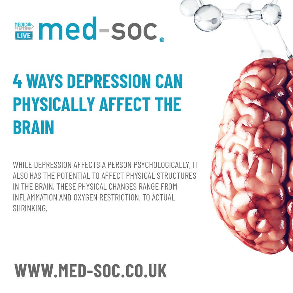 THE AFFECT THE DEPRESSION HAS ON YOUR BRAIN