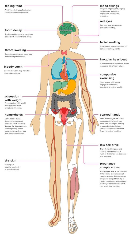 The Effects of Bulimia on Your Body