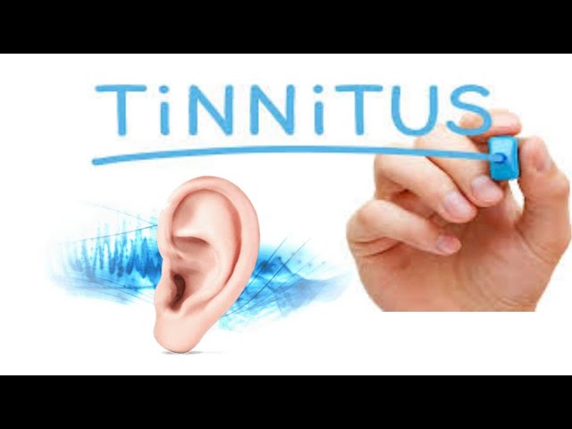 Tinnitus Treatment ,Earbuzzing Vs Schizophrenia,Homeopathy ...