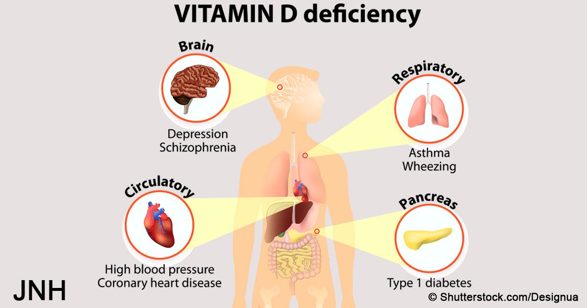 Warning: these 10 nutrient deficiencies could be making ...