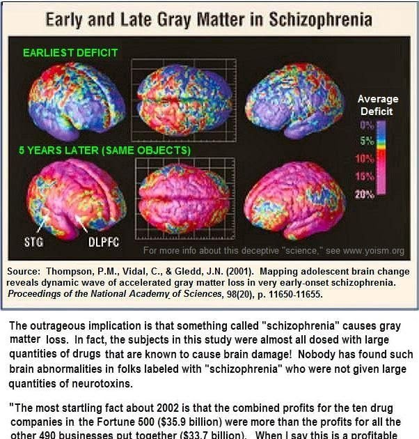 What Is Schizophrenia In Adults
