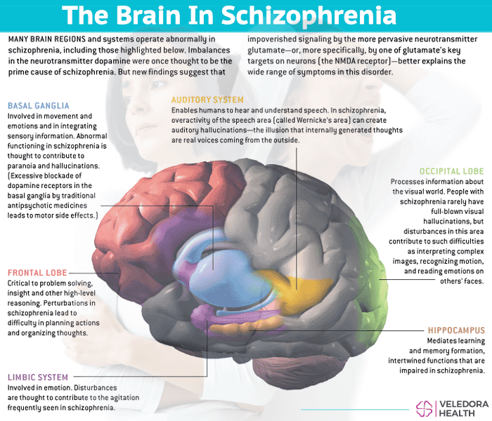 When Does Schizophrenia Start, and Who Gets it?